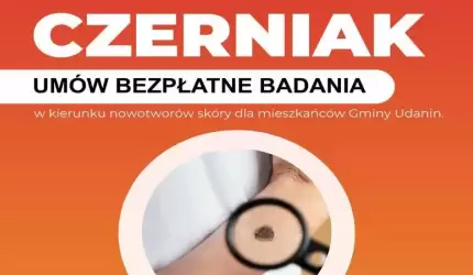 Bezpłatne badania w kierunku czerniaka dla mieszkańców Gminy Udanin