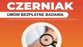 Bezpłatne badania w kierunku czerniaka dla mieszkańców Gminy Udanin