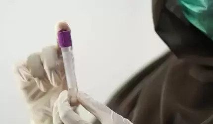 PCK apeluje: Potrzebne osocze ozdrowieńców!